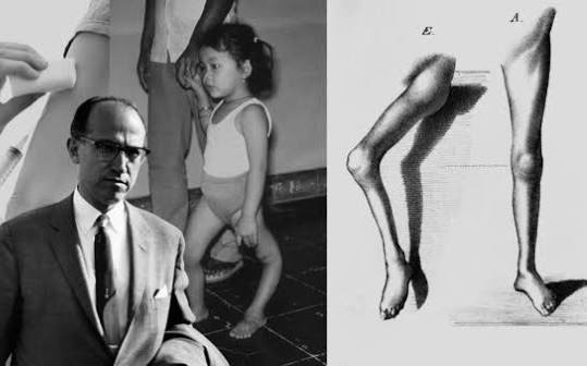 The English Name for Polio: A Disease Eradicated by Vaccines - San Diego - 1
