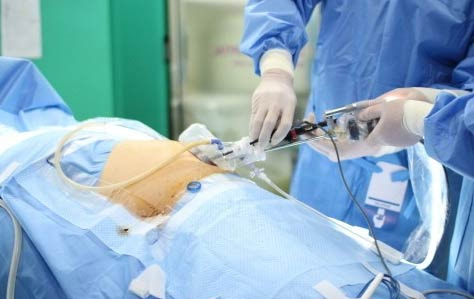 How Much Does Appendicitis Cost in the U.S.? The Reality of Surgery Expenses - Tampa - 1
