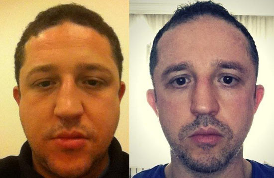 The Secret to Staying Young in Your 40s and 50s is Weight Management - Buena Park - 1