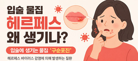Herpes Simplex Virus: It's Ultimately a Battle of Immunity - Honolulu - 2