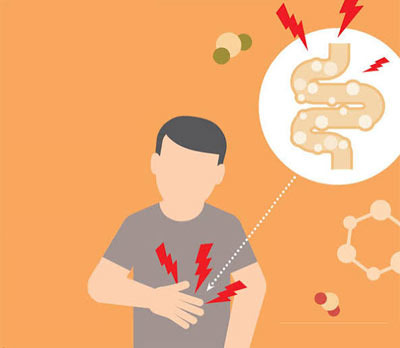 Irritable Bowel Syndrome: A Real Struggle for Working Men - Annandale - 1