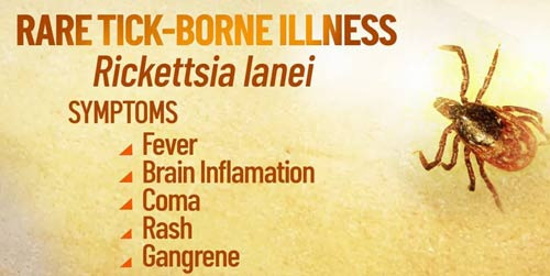 Information on Bugs, Allergies, and Endemic Diseases to Watch Out for in San Jose - San Jose - 1
