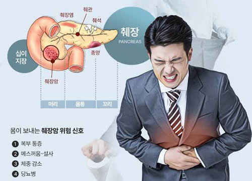 Why Do We Say It's Too Late When Pancreatic Cancer Is Detected? - Annandale - 1